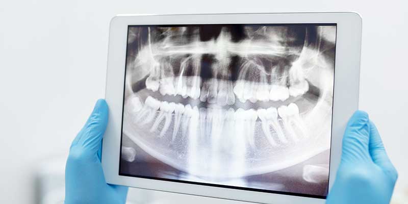 Dental Intraoral Imaging Display